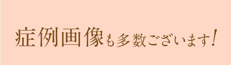 症例画像