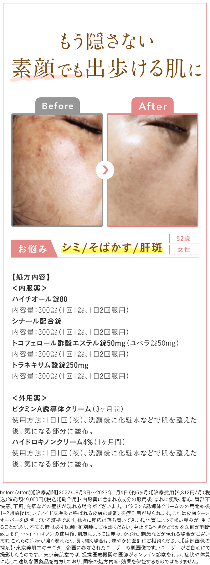 Before After