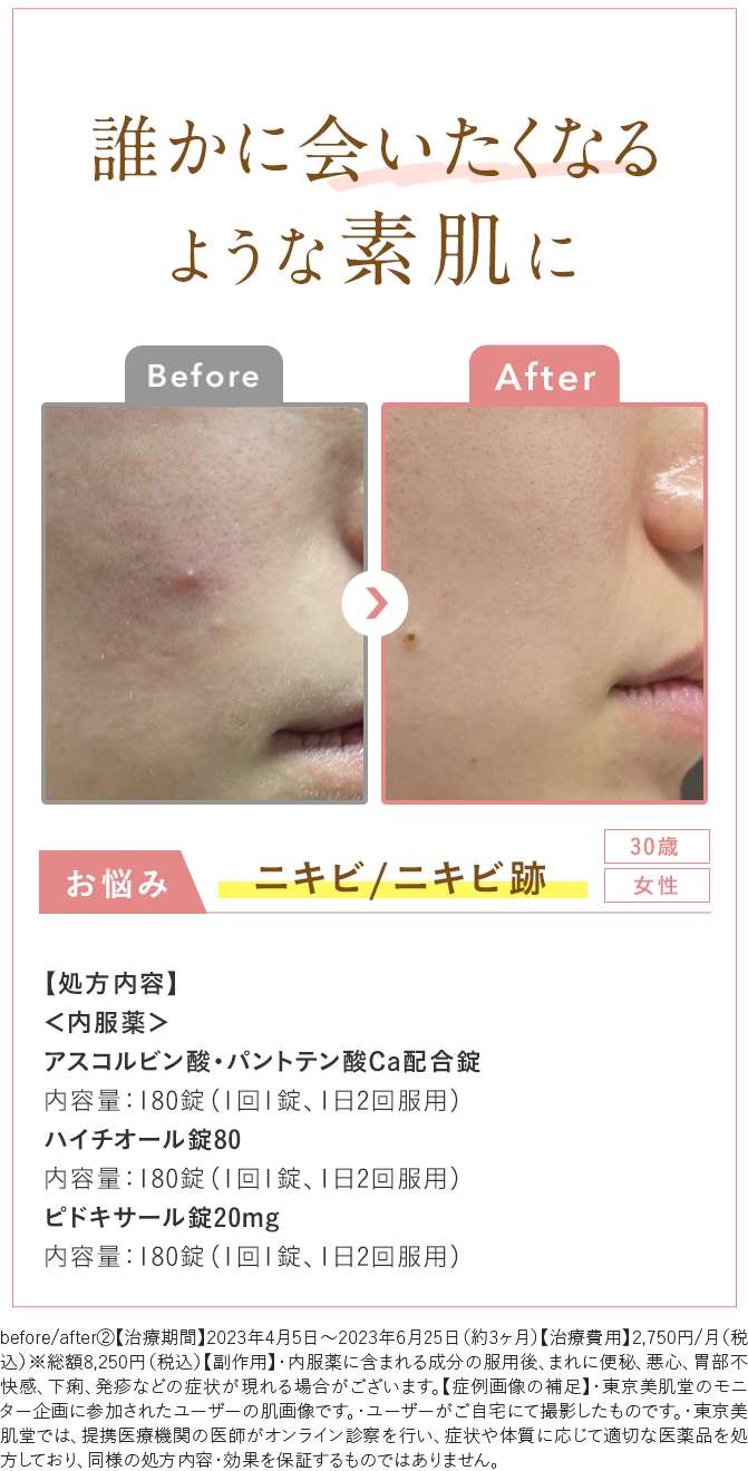 Before After