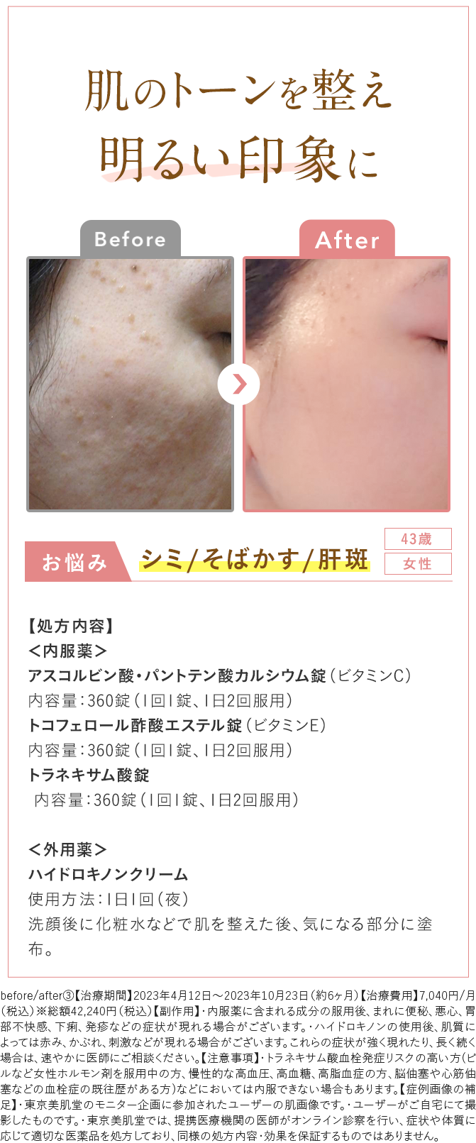 Before After