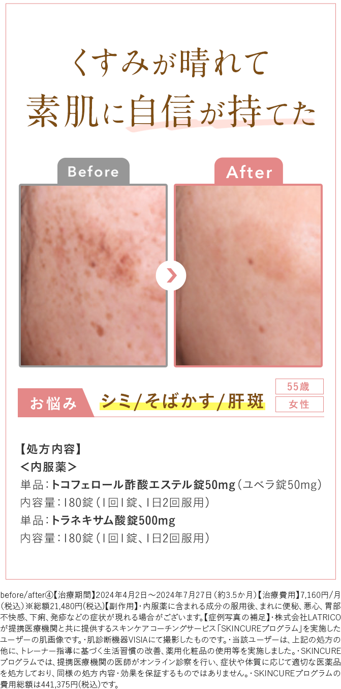 Before After