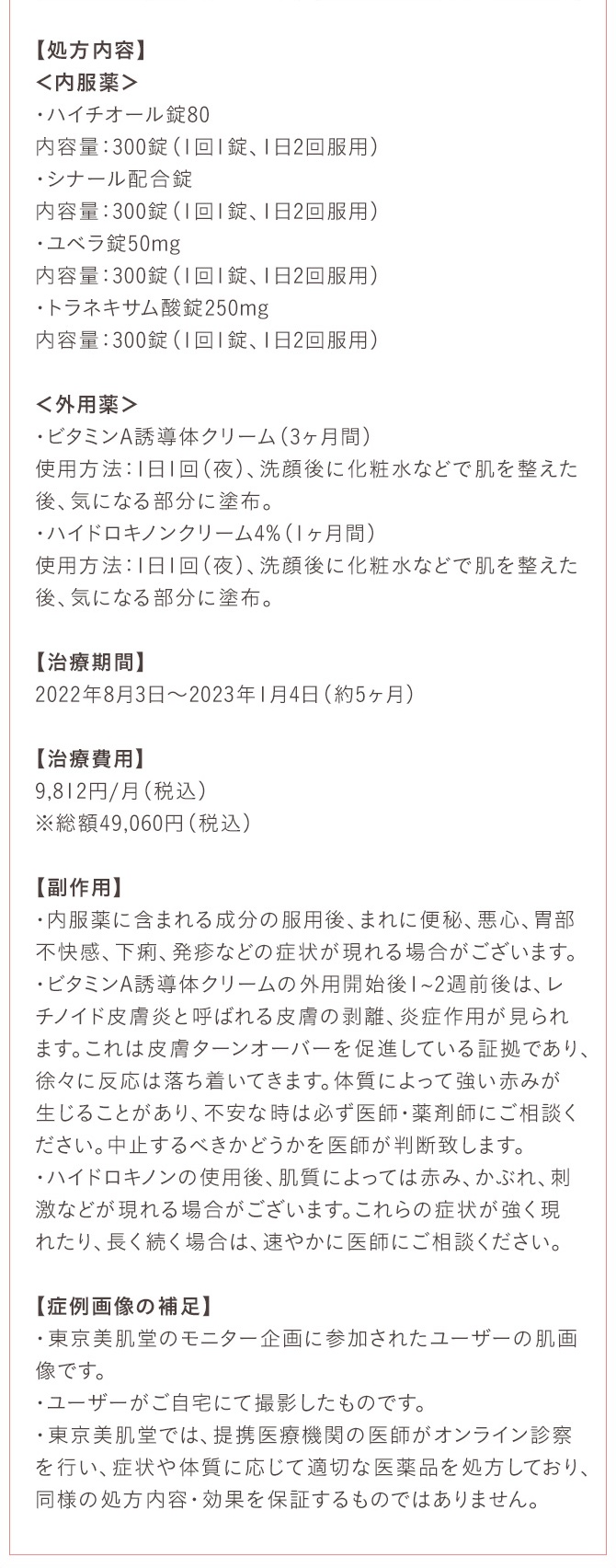 とことん美白対策セット/ハイドロキノン4%クリーム