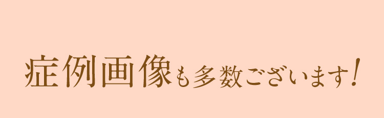 治療の症例画像も多数ございます。