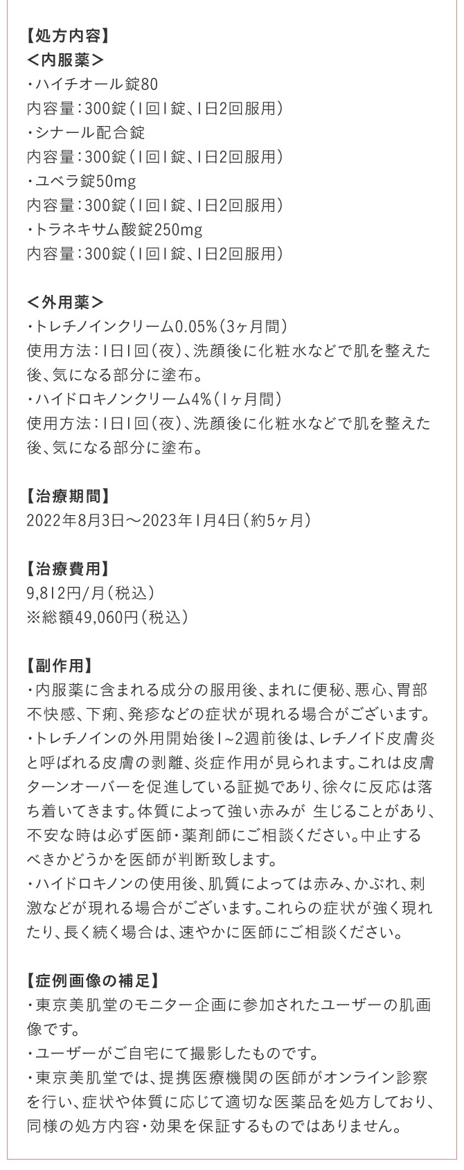 【処方内容】とことん美白対策基本セット/トレチノインクリーム0.05%/ハイドロキノン４％クリーム