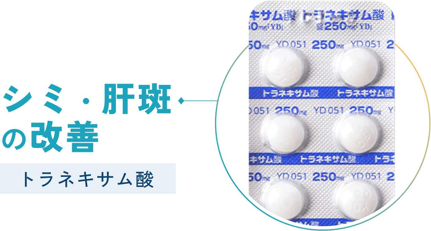 シミ・肝斑の改善 トラネキサム酸