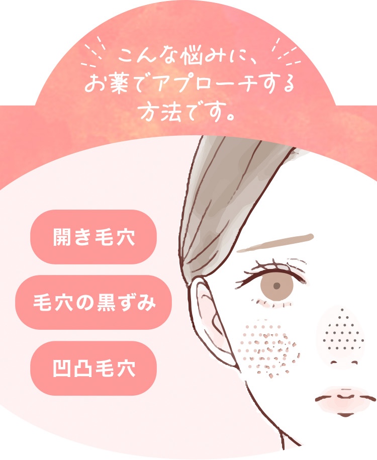こんな悩みにお薬でアプローチする方法です。